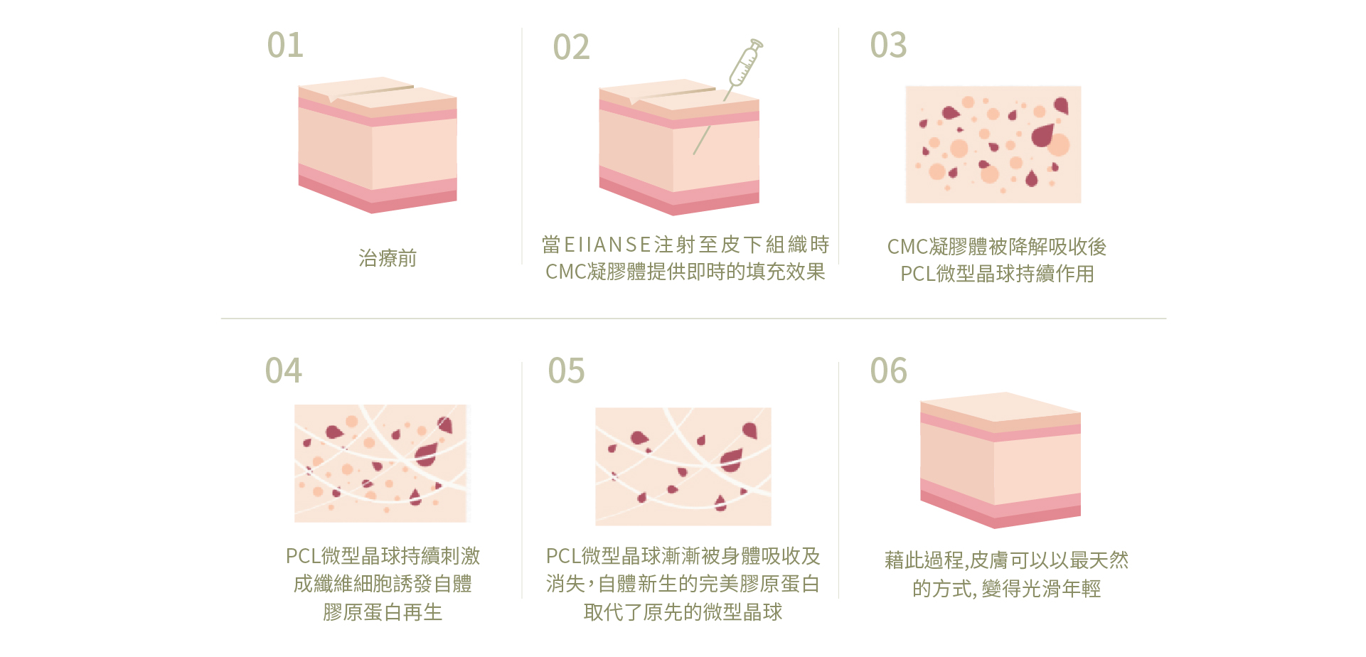 青春微整_洢蓮絲＿療程介紹