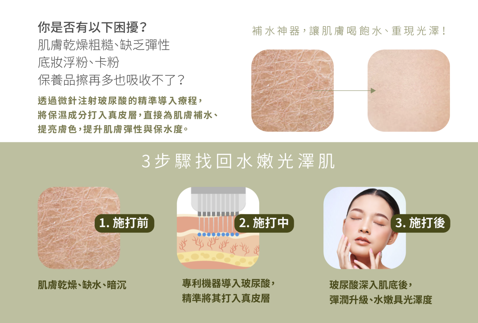 水光注射流程說明