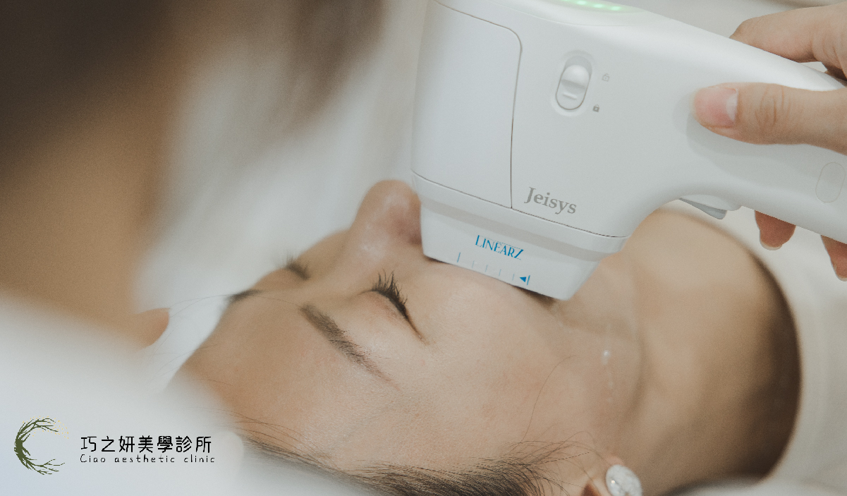 巧之妍美學診所施打z音波