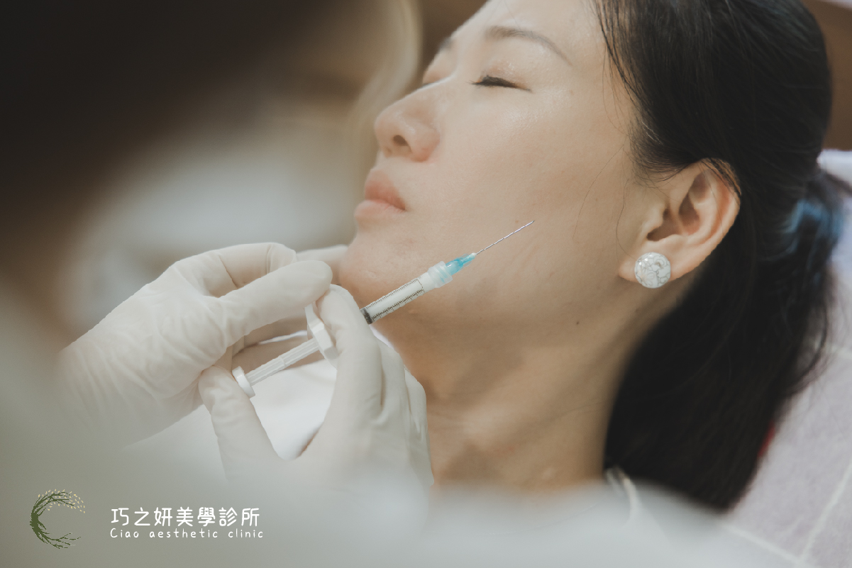 洢蓮絲豐額效果?可以維持多久?