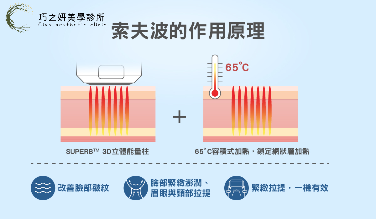 索夫波Sofwave的作用原理