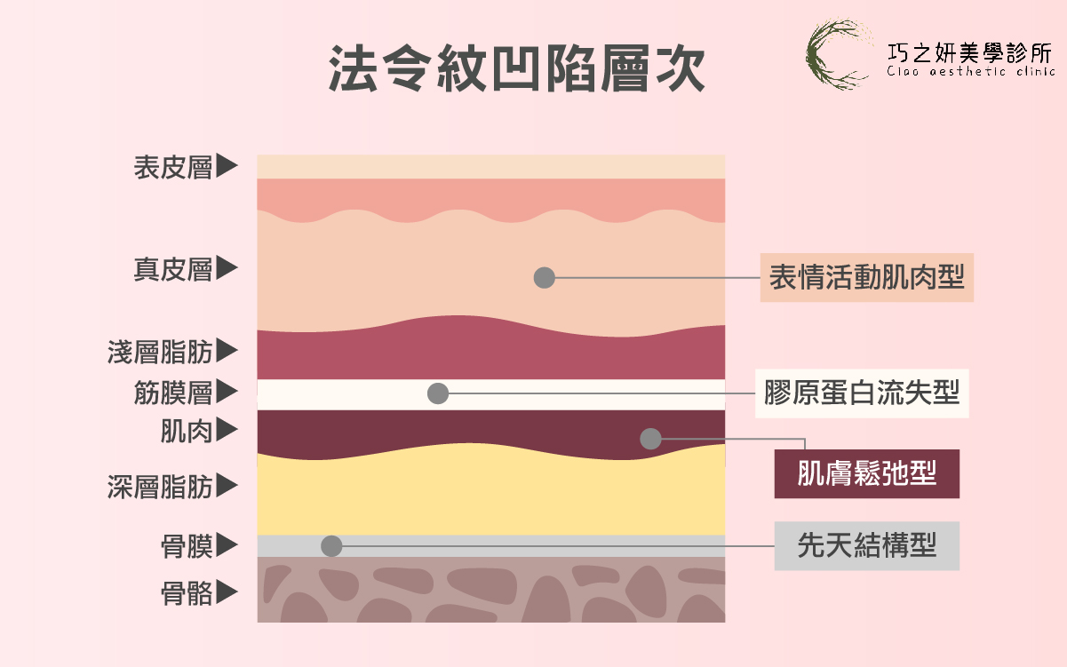 法令紋不是老化那麼簡單-02