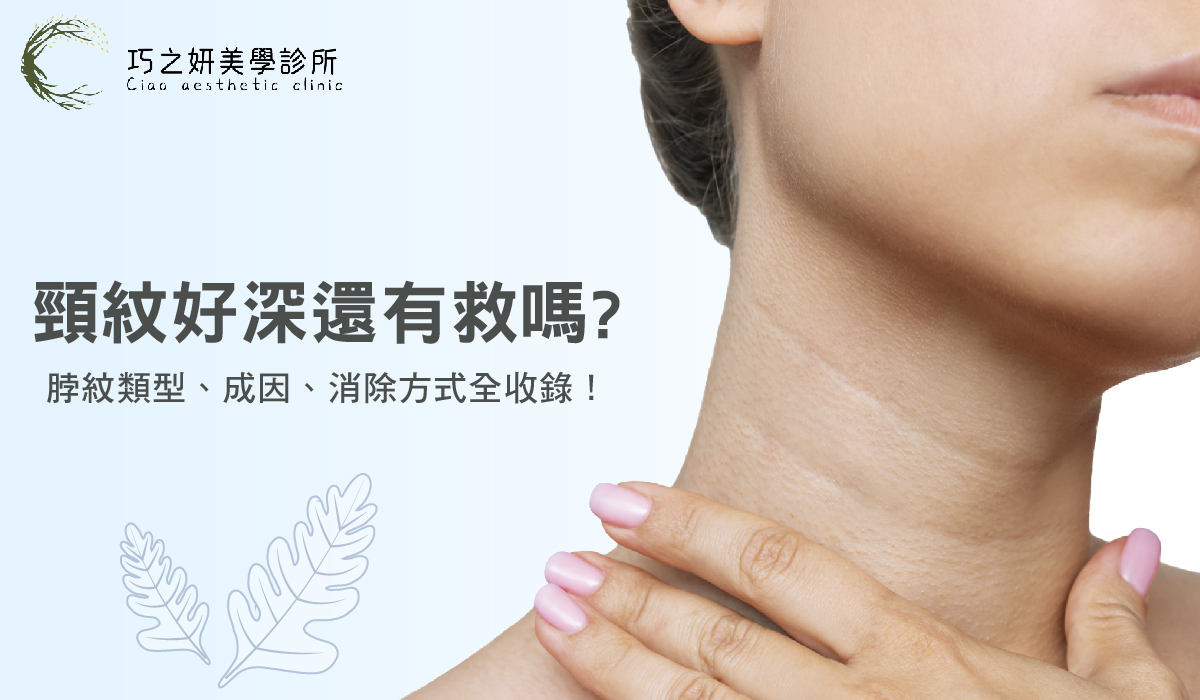 頸紋好深還有救嗎?脖紋類型、成因、消除方式全收錄!