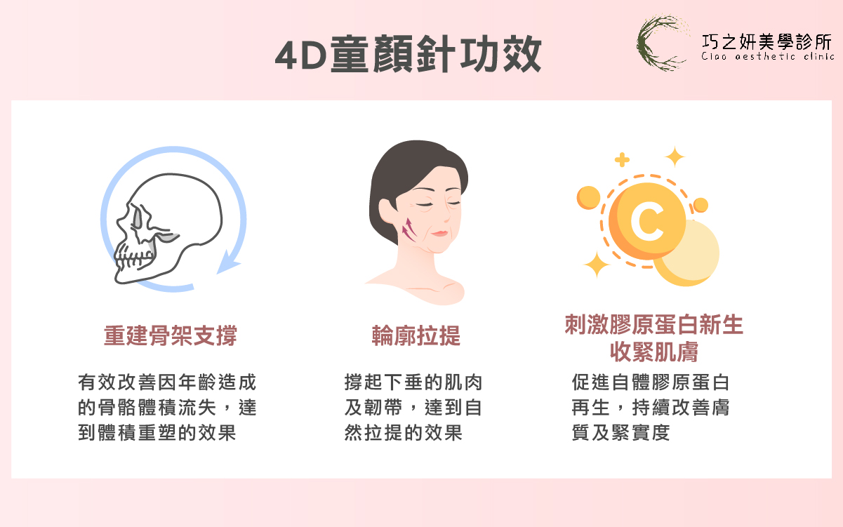 巧之妍250821A打玻尿酸就夠了嗎--4D童顏針功效