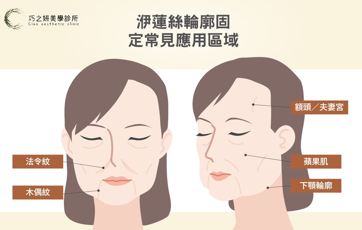 巧之研-250730A輪廓固定是什麼-03