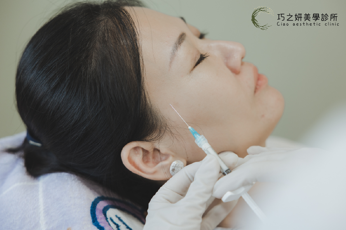 巧之研-250730A輪廓固定是什麼-07_0