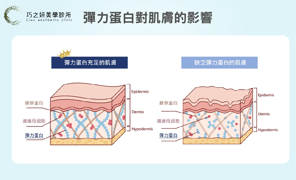 巧之研-Profhilo逆時針的作用原理：刺激膠原蛋白＆彈力蛋白同步增生