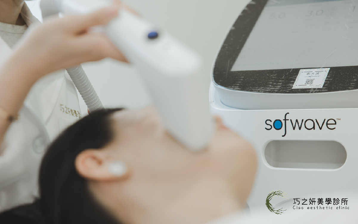 巧之妍-嘴邊肉治療索夫波 Sofwave