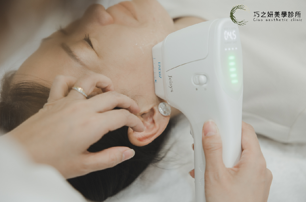 Z音波(Linear Z)中文全名為「婕希零聚焦超音波系統