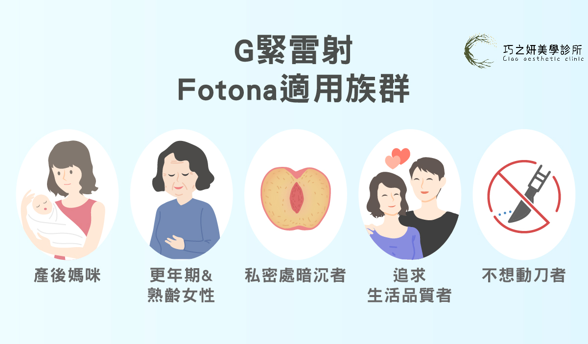 G緊雷射（Fotona）適合有產後鬆弛、陰道乾澀、輕中度漏尿、私密處暗沉等困擾的女性，不分年齡、性經驗或是否生育，都可藉此改善陰道緊實、滋潤度、美觀，達到保養效果。