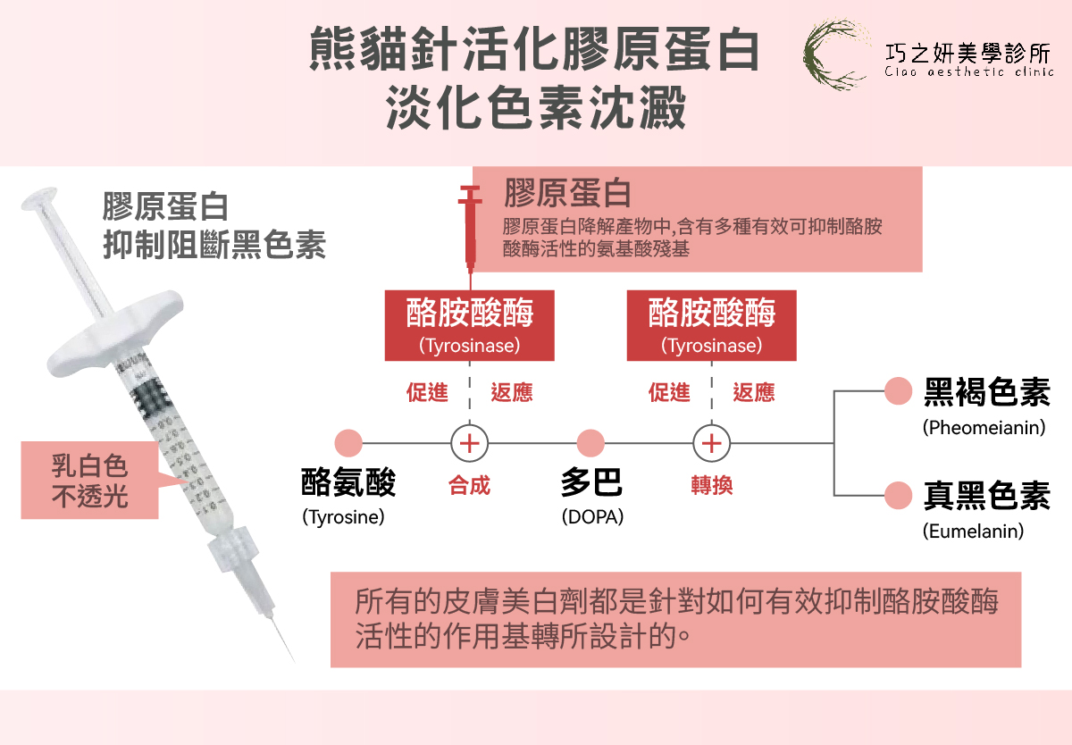 為什麼熊貓針（雙美膚力原膠原蛋白植入劑）被稱為黑眼圈救星？以醫學角度來看，熊貓針的出發點是「深層滋養」而非單純的體積填充。 透過複合式成分的協同作用，滋養眼周脆弱的皮膚。眼周常見的困擾，包括血管型黑眼圈、皮膚薄透、眼周鬆弛等。