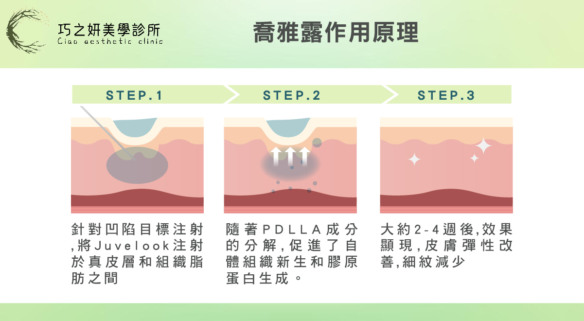 Juvelook 喬雅露：雙重機制找回青春支撐力