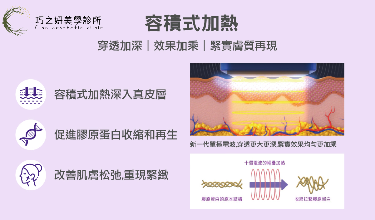 十蓓電波的核心優勢在於「容積式加熱」。 這意味著能量是「整塊」體積的均勻升溫。當熱能進入真皮層後，會將組織加熱至 40~60°C 的有效區間。這個溫度能溫和地刺激膠原蛋白纖維收縮，並啟動後續的新生機制。