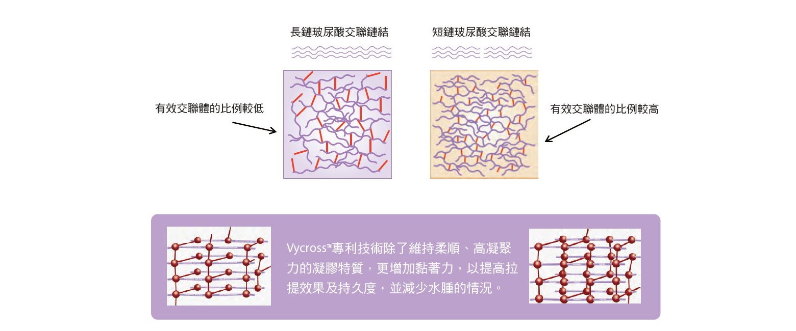 喬雅登進階 Vycross技術：持久長效的塑型力這是喬雅登（Juvéderm）目前最新的技術，它解決了傳統玻尿酸「容易吸水腫脹」與「支撐力不足」的問題。