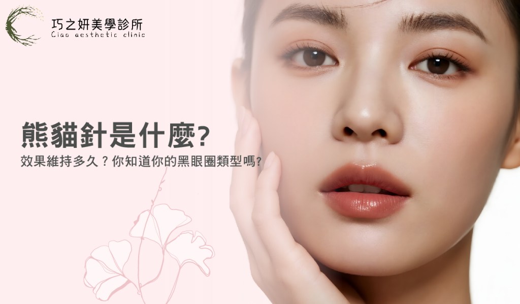 熊貓針是什麼？效果維持多久？你知道你的黑眼圈類型嗎？