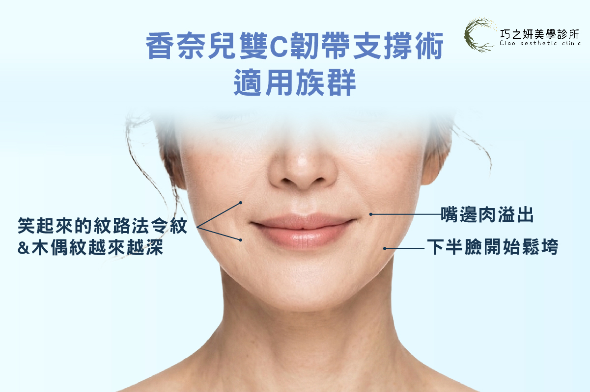 誰適合香奈兒雙C韌帶支撐術打法？ 