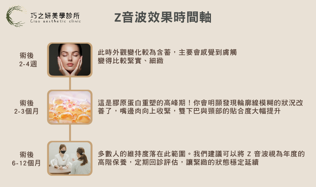 Z音波多久有效果