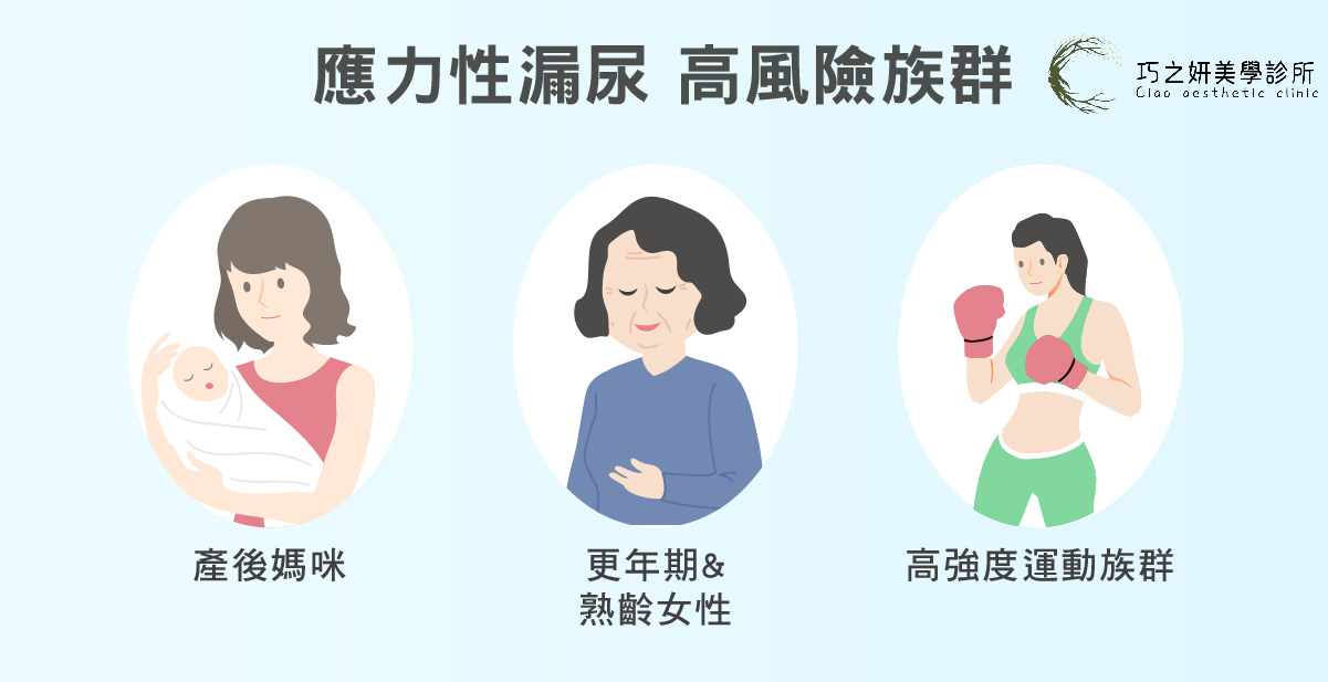 應力性尿失禁的常見族群