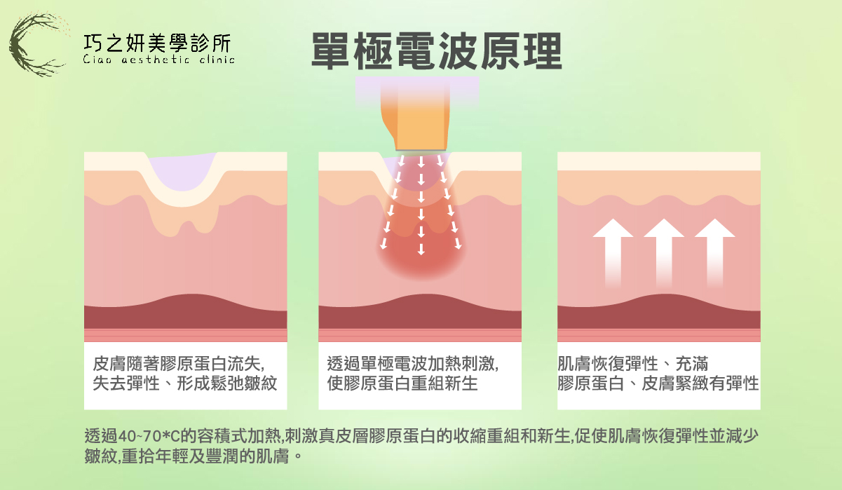 十蓓電波打底：單極電波原理 