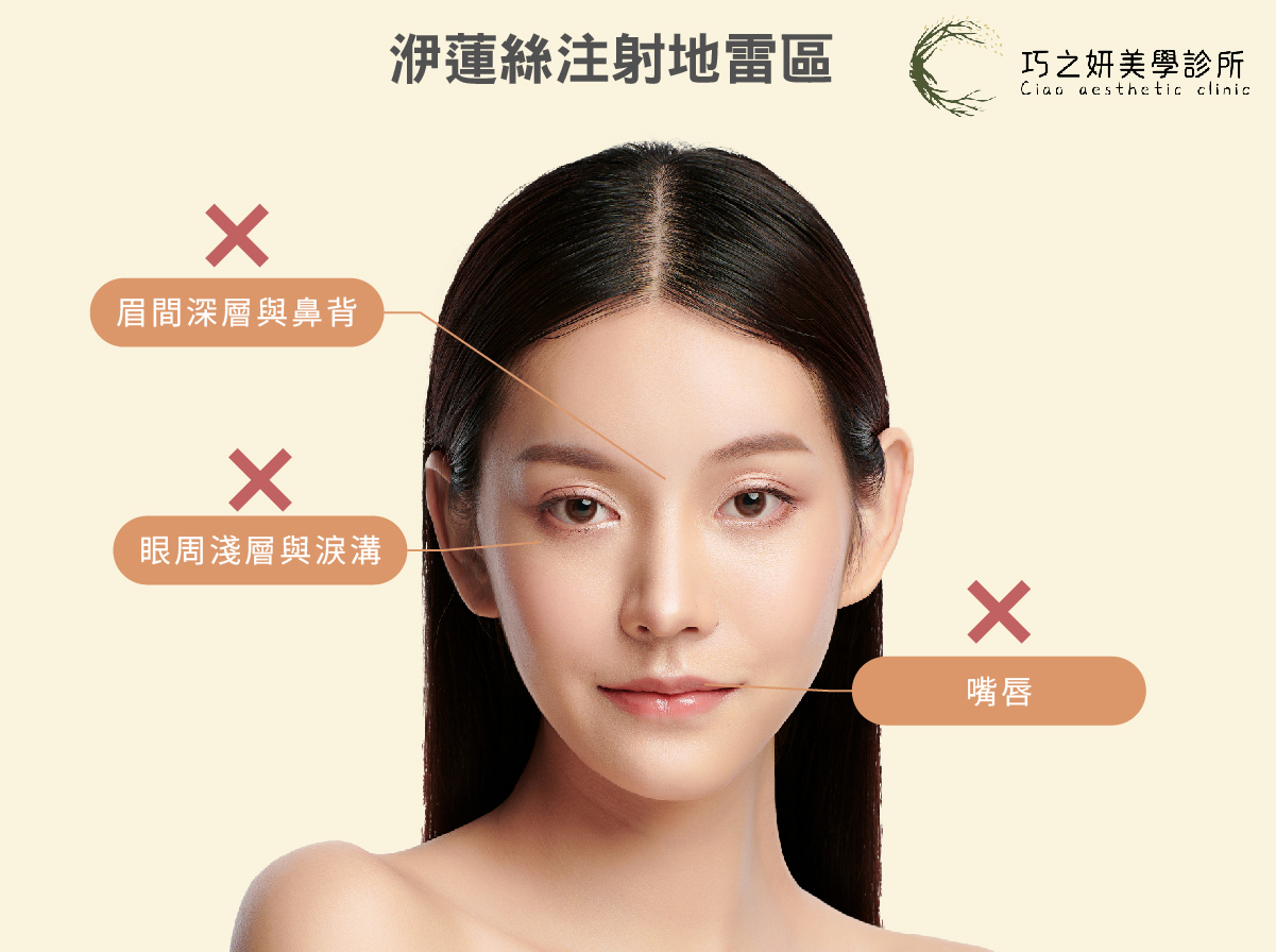 雖然洢蓮絲Ellansé能促進膠原增生,但基於材質特性與解剖學的安全考量,有幾個部位我們「強烈不建議」施打