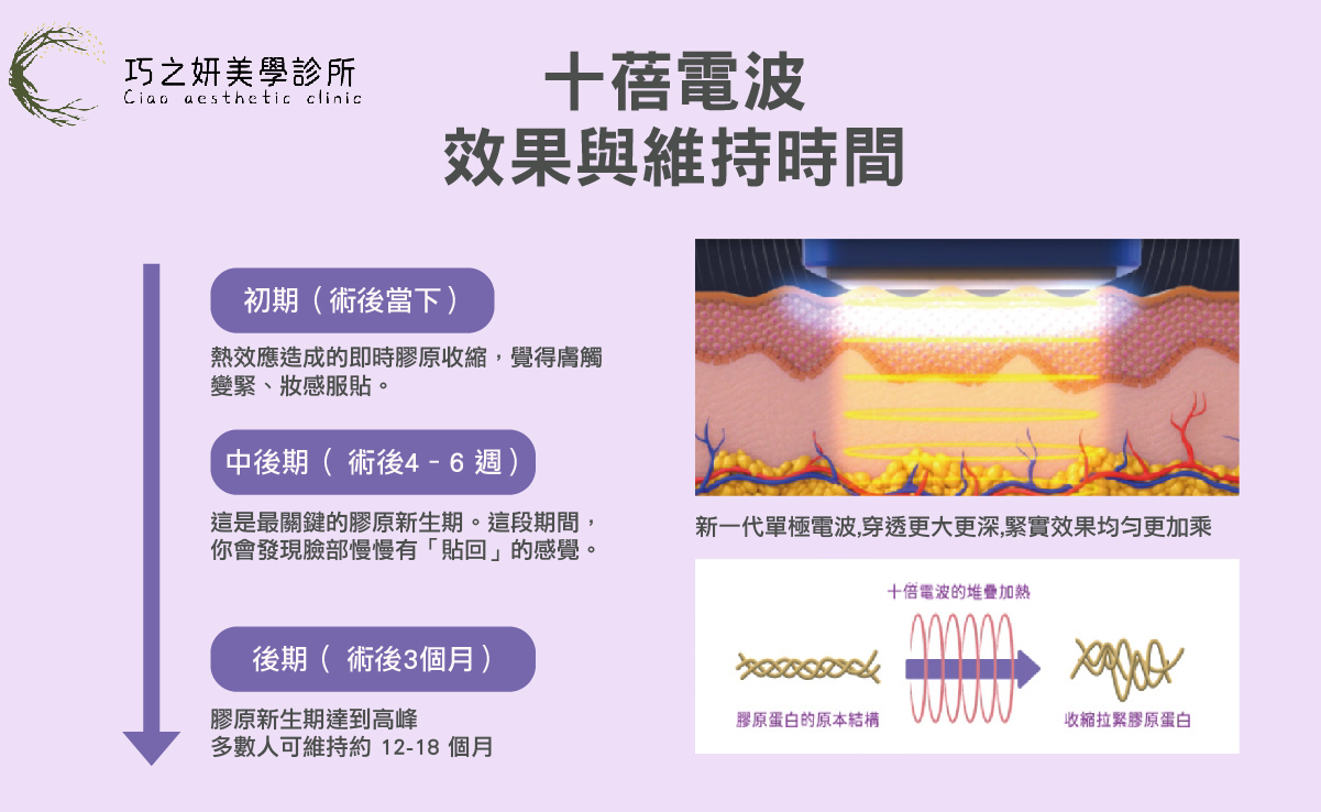十蓓電波屬於「容積式加熱