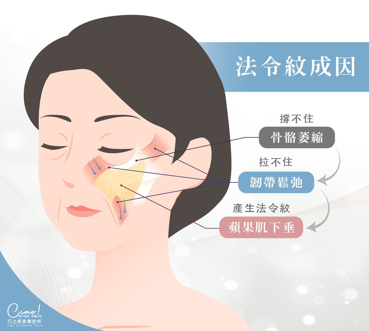 法令紋成因及改善方法