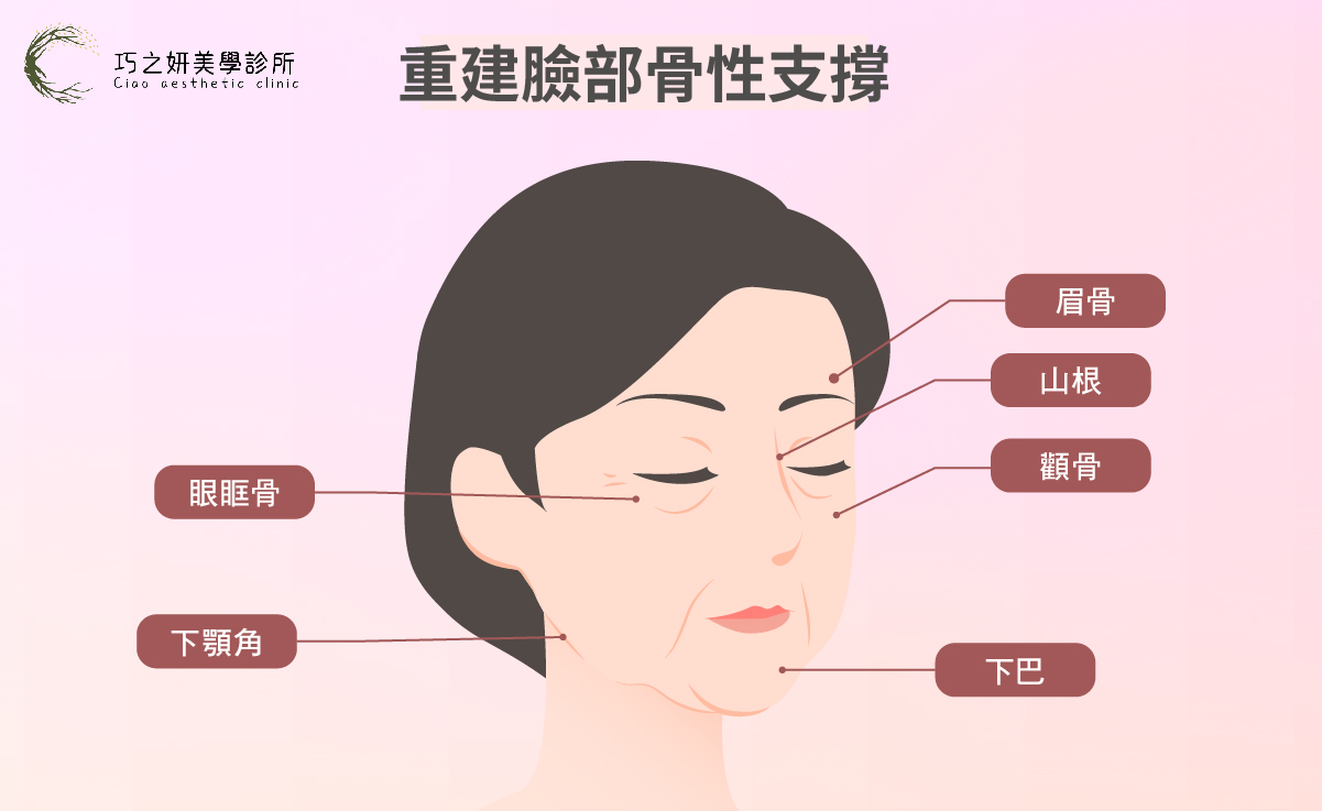 骨性支撐