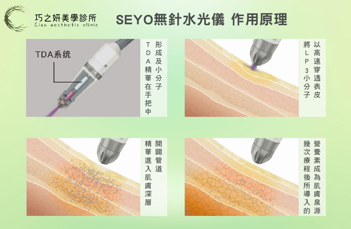 無針水光是什麼