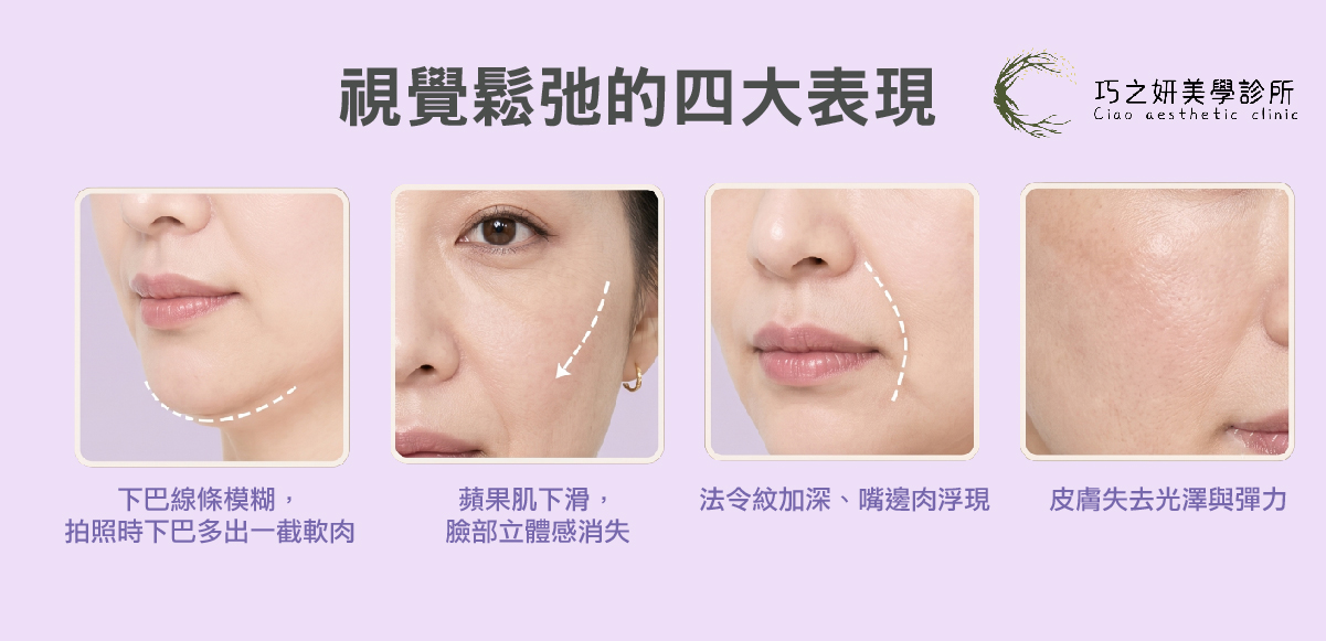 面部視覺鬆弛的四大表現