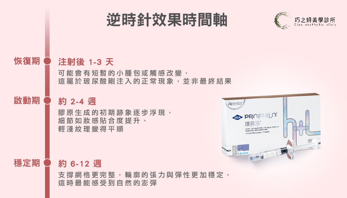逆時針效果時間軸
