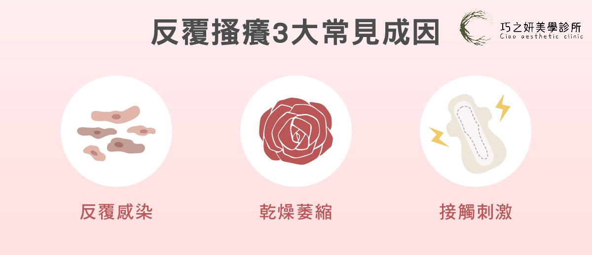 私密處反覆搔癢3大常見成因