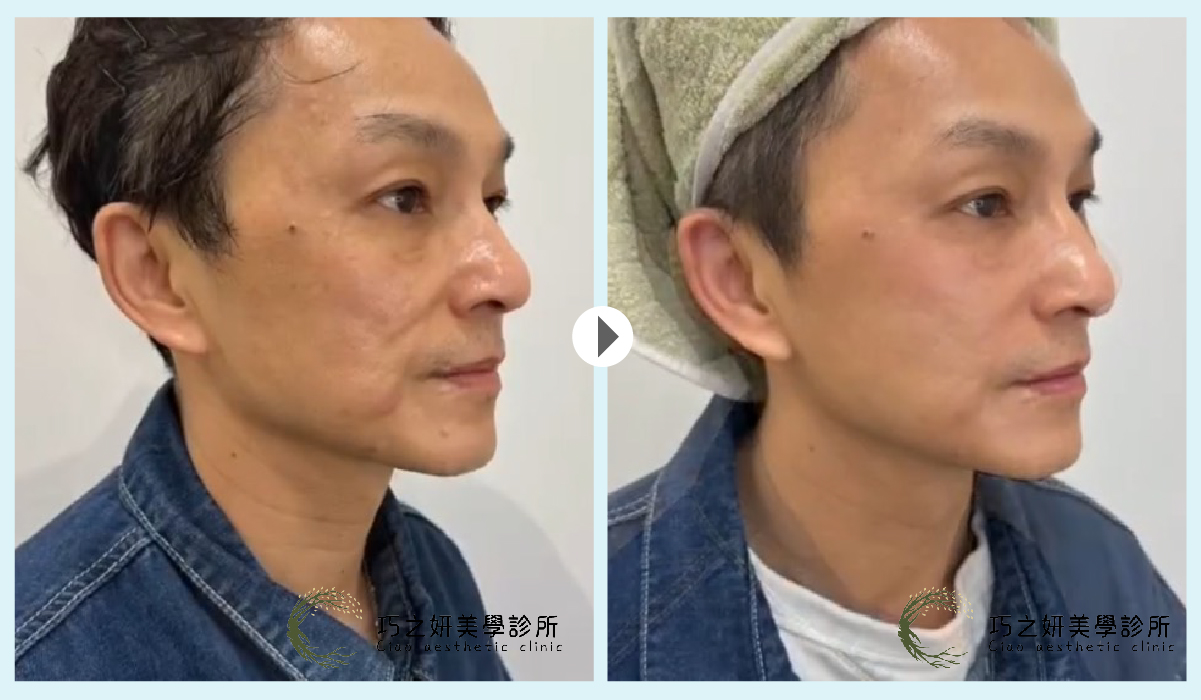 醫美對比