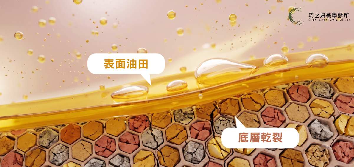 外油內乾肌 