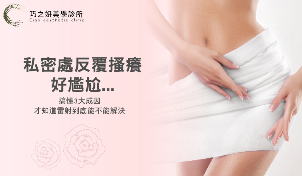 私密處反覆搔癢好尷尬？搞懂3大成因，才知道雷射到底能不能解決