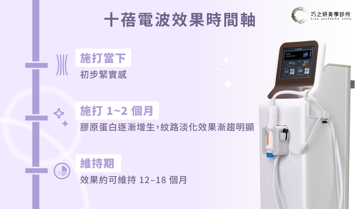 十蓓電波效果時間軸